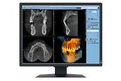 Näyttö - 21" EIZO RadiForce MX217-SB - 1200x1600 - IPS - MX217-SB