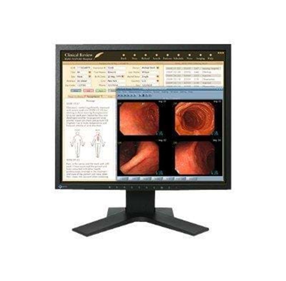 Näyttö - 19" EIZO RadiForce MX191 - MX191-BK